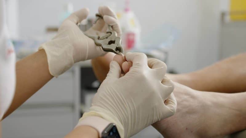 Podiatrist clipping a patient's toenails with toenail clippers